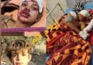 و خون ایلام که هنوز بند نیامده است!/ آیا میراث شوم صدام باید به فرزندان و نوه های ما هم برسد؟!